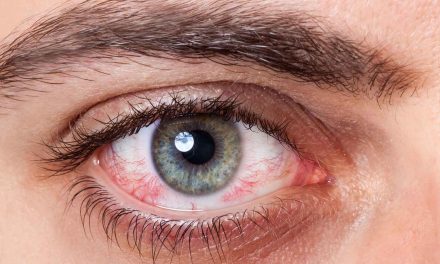 Ablasi Retina, Mari Kenali Penyebab, Gejala Dan Pengobatannya