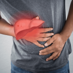 Penyakit Hepatitis Peradangan Pada Hati Karena Infeksi Virus