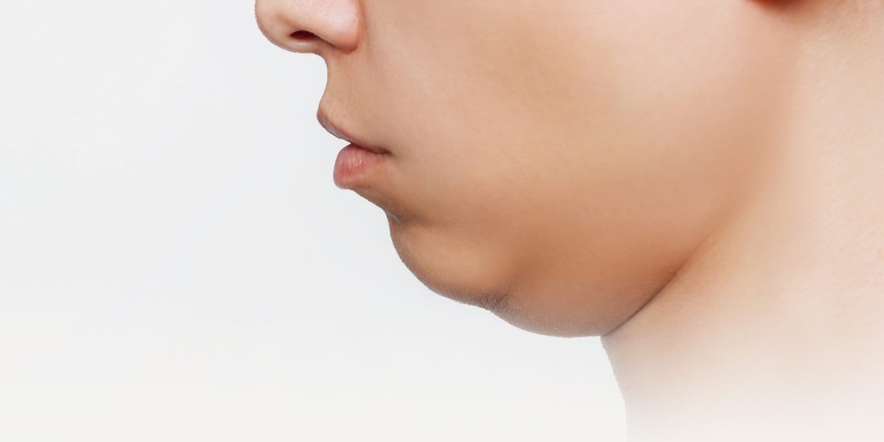 Double Chin Bikin Sebal Karena Mengganggu Penampilan