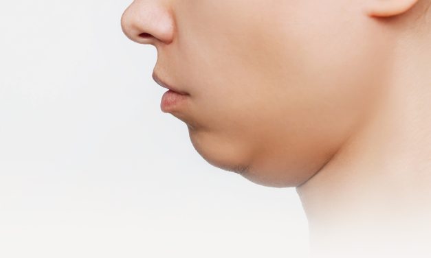 Double Chin Bikin Sebal Karena Mengganggu Penampilan
